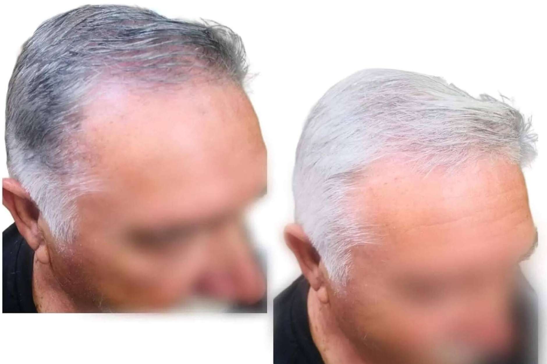 La Cera Negra Anti-Canas de Saw Palmetto que asegura fijación perfecta en el cuidado capilar masculino