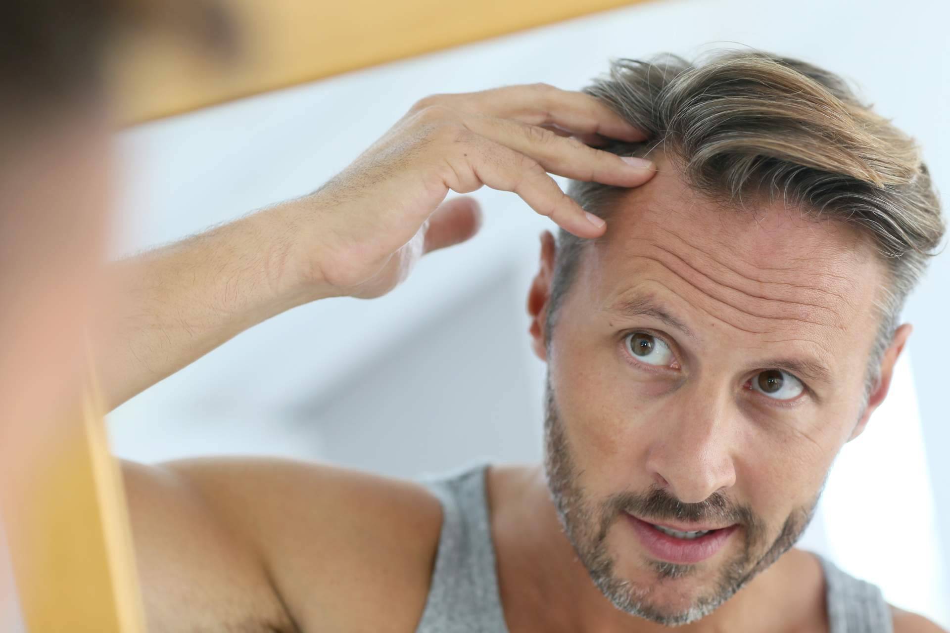 Saw Palmetto ofrece una solución natural y efectiva para la caída del cabello