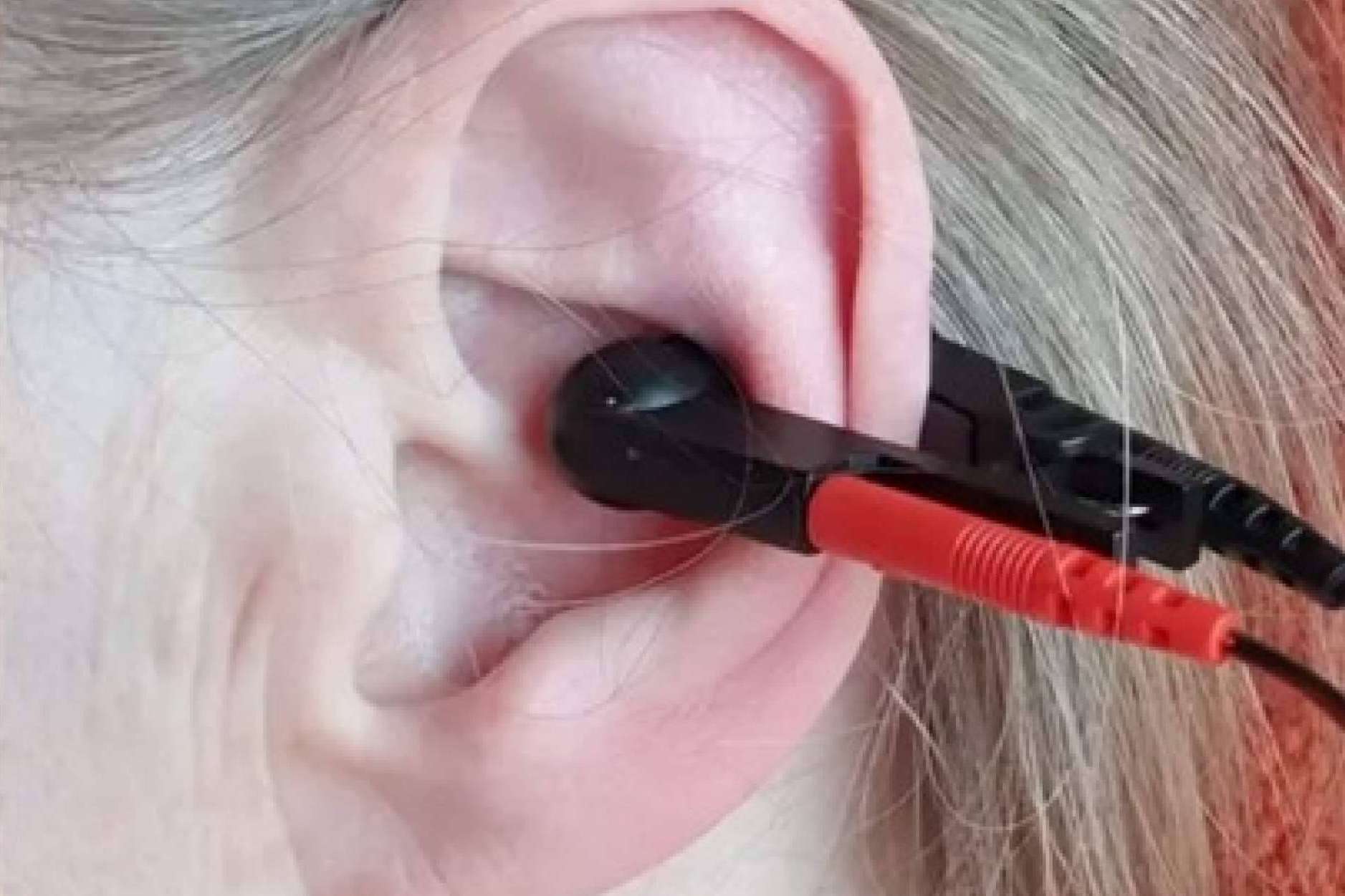 ALPERK es el nuevo estimulador de nervio vago para neurorrehabilitación de GOGOA