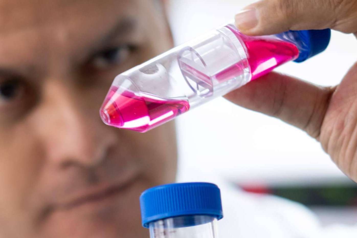 Oncovix; Inmunoterapia de Precisión, un Hito en la Revolución del Tratamiento del Cáncer