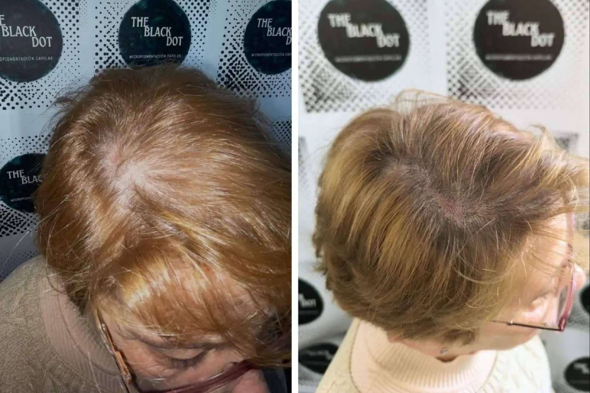 Confianza y cabello; La solución en Murcia