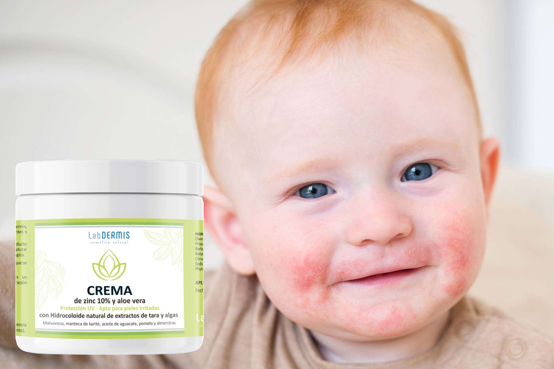 ¿Se puede confiar en la cosmética natural para cuidar la piel atópica con dermatitis? Responde LabDERMIS