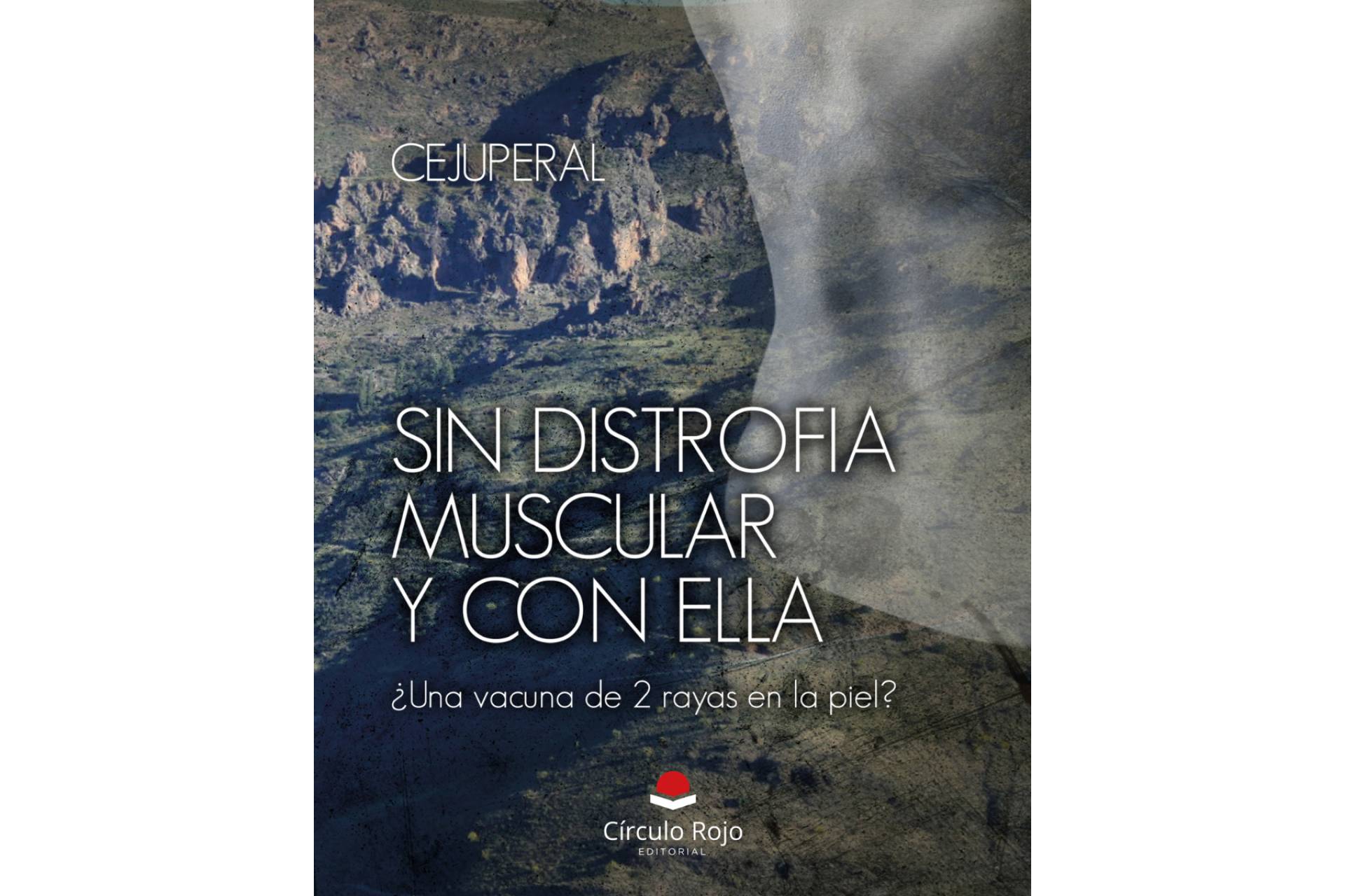 “Sin distrofia muscular y con ella. ¿Una vacuna de 2 rayas en la piel?”, una obra que desafía los límites