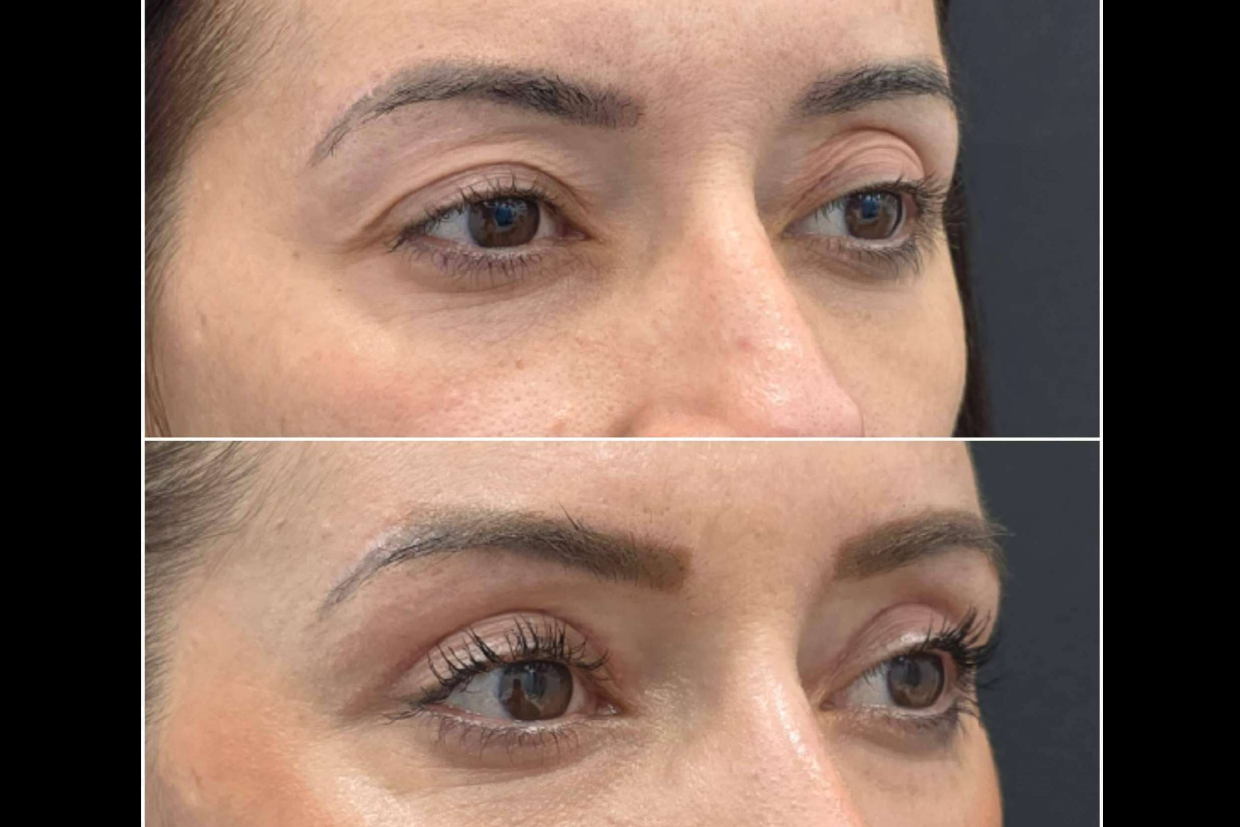 360Clinics redefine la blefaroplastia con EyeEvolution360; intervención precisa y sin hospitalización
