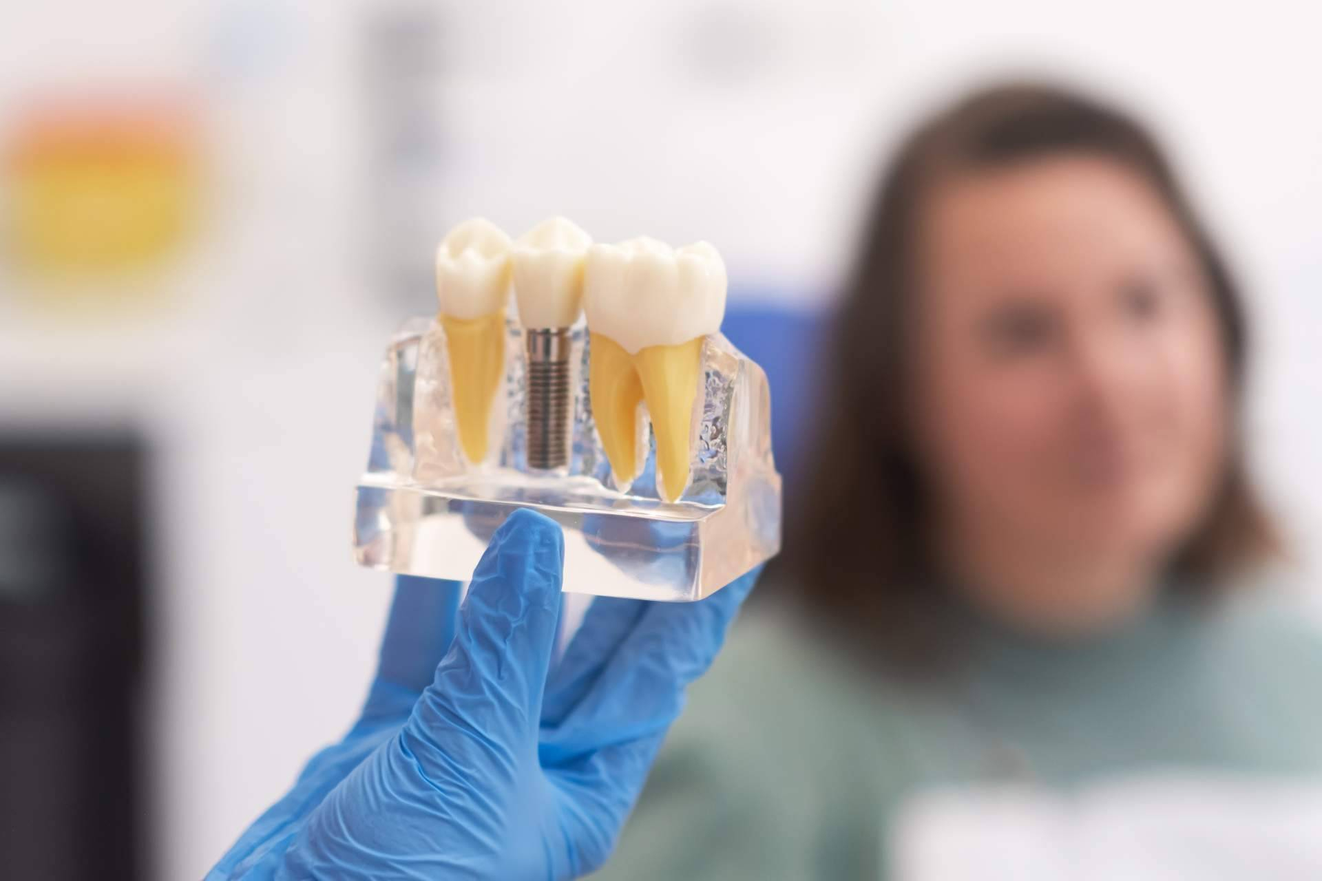 CML Odontólogos consolida en A Coruña el éxito de los implantes dentales de carga inmediata