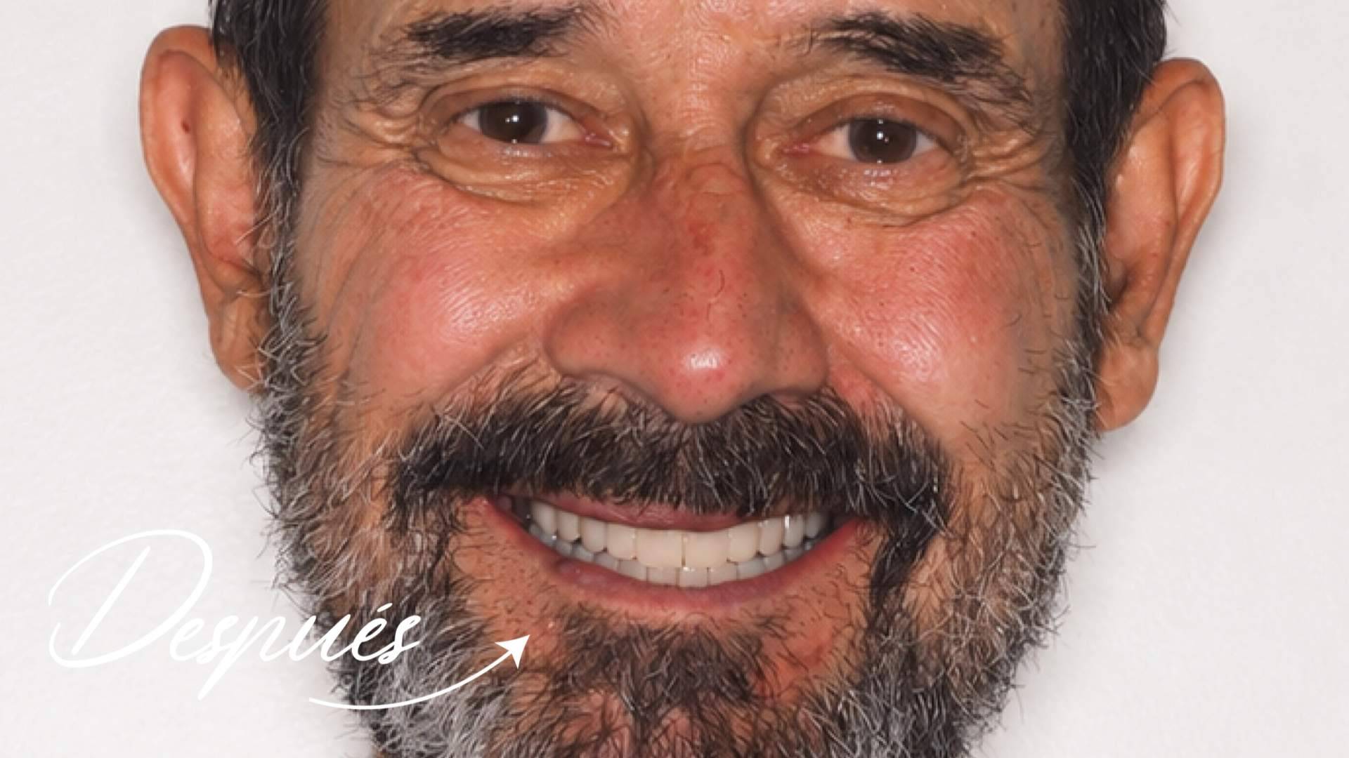 Clínica Calvo de Mora se consolida como referente en cirugía maxilofacial e implantología dental avanzada en Madrid